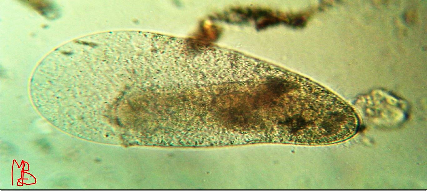 Ciliato da determinare